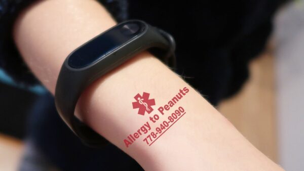 Peanut allergy temporary tattoos